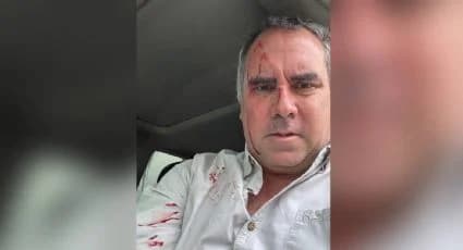 Atentan contra candidato presidencial peruano; resulta con heridas leves